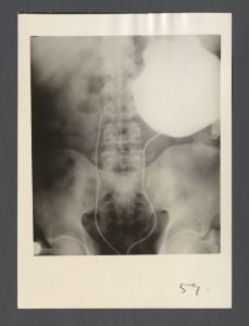 School of Medicine - X-ray of a human spine and pelvis